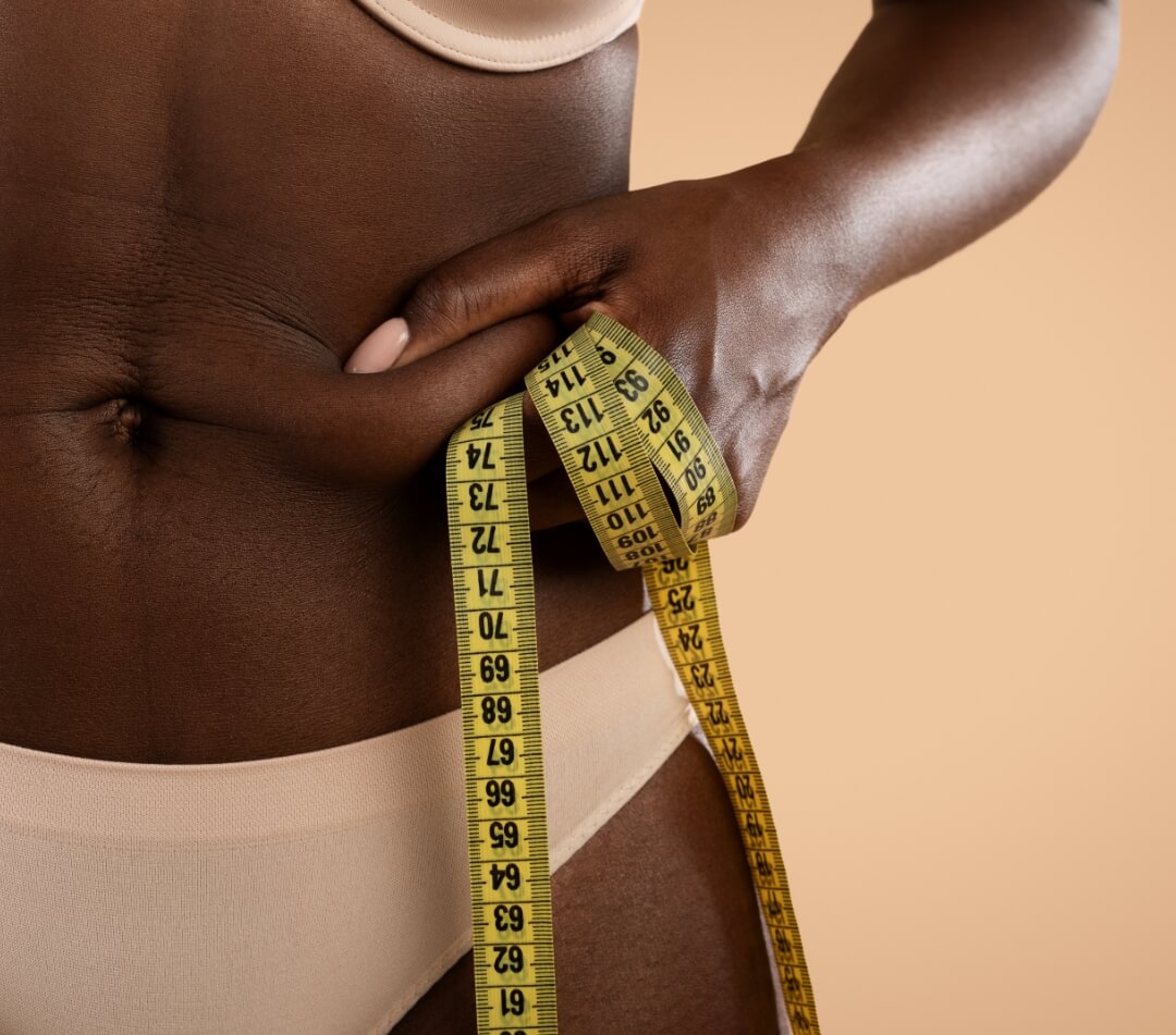 cropped-of-black-woman-in-underwear-pulling-skin-o-2023-11-27-04-49-15-utc (1)